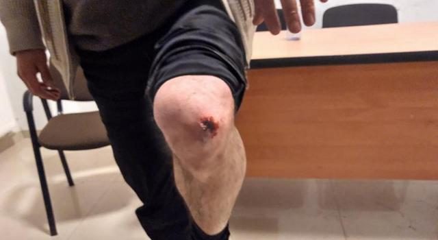 Инцидент в Ахалцихе: “Нацдвижение” VS. “Мечты”